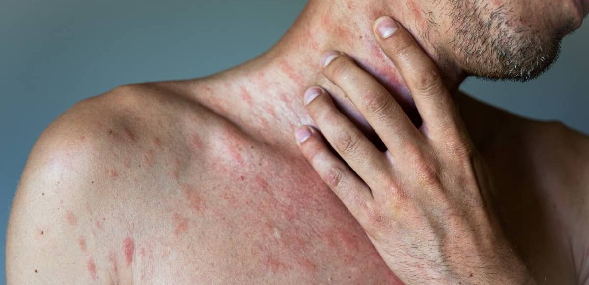 Novartis, alternativa terapeutica